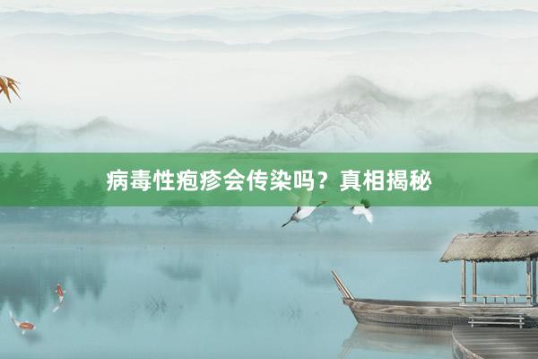 病毒性疱疹会传染吗？真相揭秘